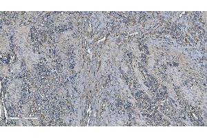 IHC analysis of PNPT1 using anti-PNPT1 antibody (ABIN7599172). (PNPT1 Antikörper  (AA 1-257))
