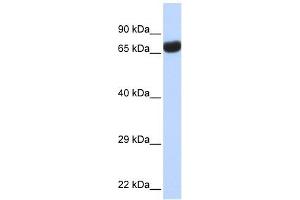 TPTE antibody used at 1 ug/ml to detect target protein.