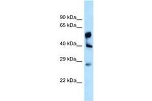 Image no. 1 for anti-Lysophosphatidylglycerol Acyltransferase 1 (LPGAT1) (AA 230-279) antibody (ABIN6747957) (LPGAT1 Antikörper  (AA 230-279))