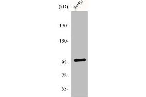 Western Blot analysis of HeLa cells using MRTF-A Polyclonal Antibody (MKL1 Antikörper  (N-Term))