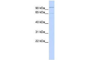 WB Suggested Anti-ZNF30 Antibody Titration:  0. (ZFP30 Antikörper  (Middle Region))