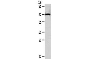 Western Blotting (WB) image for anti-Carnitine Palmitoyltransferase 2 (CPT2) antibody (ABIN2425697)