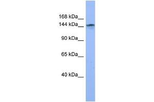 WB Suggested Anti-COL4A3 Antibody Titration: 0. (COL4a3 Antikörper  (Middle Region))