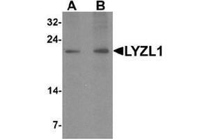 Western blot analysis of LYZL1 in A20 cell lysate with LYZL1 Antibody  at (A) 1 and (B) 2 ug/mL.