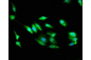 Immunofluorescence staining of Hela cells with ABIN7168982 at 1:100, counter-stained with DAPI. (STK24 Antikörper  (AA 1-431))