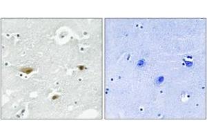Immunohistochemistry analysis of paraffin-embedded human brain, using STK39 (Phospho-Ser325) Antibody.