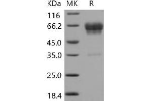 Western Blotting (WB) image for CD99 Molecule-Like 2 (CD99L2) protein (Fc Tag) (ABIN7320249) (CD99L2 Protein (Fc Tag))