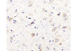 Immunohistochemistry analysis of paraffin-embedded mouse spinal marrow using NTRK2 Polyclonal Antibody at dilution of 1:400. (TRKB Antikörper)