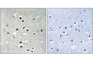 Immunohistochemistry analysis of paraffin-embedded human brain, using MEF2C (Phospho-Ser396) Antibody. (MEF2C Antikörper  (pSer396))