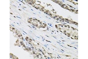 Immunohistochemistry of paraffin-embedded Human prostate using TCEB1 Polyclonal Antibody (TCEB1 Antikörper)