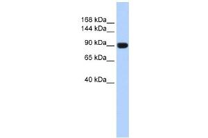 TMEM16A antibody used at 1 ug/ml to detect target protein. (ANO1 Antikörper  (Middle Region))