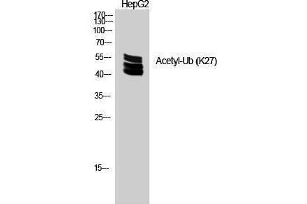 Ubiquitin Antikörper  (acLys27)