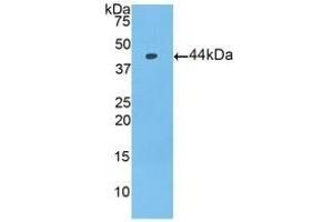 Detection of Recombinant PIP, Mouse using Polyclonal Antibody to Prolactin Induced Protein (PIP) (PIP Antikörper  (AA 1-146))