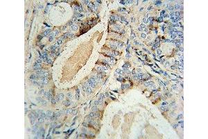 Immunohistochemistry (IHC) image for anti-Glucosaminyl (N-Acetyl) Transferase 2, I-Branching Enzyme (I Blood Group) (GCNT2) (AA 364-391) antibody (ABIN3031054)