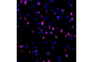 Immunofluorescence (Paraffin-embedded Sections) (IF (p)) image for anti-Hepatoma-Derived Growth Factor-Related Protein 3 (HDGFRP3) antibody (ABIN7074198)