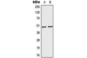 Western blot analysis of Caspase 9 expression in HeLa (A), Jurkat (B) whole cell lysates. (Caspase 9 Antikörper  (Center))