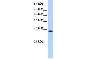 MBNL1 antibody used at 0.