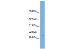 Image no. 1 for anti-Fragile Histidine Triad (FHIT) (C-Term) antibody (ABIN6744905) (FHIT Antikörper  (C-Term))