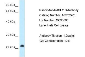 Western Blotting (WB) image for anti-RAS-Like, Family 11, Member B (RASL11B) (C-Term) antibody (ABIN2789131)