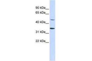 Image no. 1 for anti-Zinc Finger Protein 398 (ZNF398) (AA 180-229) antibody (ABIN6742330)