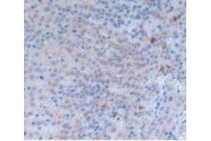 Detection of INHbA in Rat Adrenal Gland Tissue using Monoclonal Antibody to Inhibin Beta A (INHbA) (INHBA Antikörper  (AA 314-424))