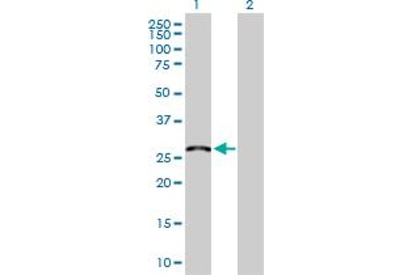 MED6 Antikörper  (AA 1-246)