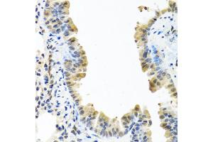 Immunohistochemistry of paraffin-embedded mouse lung using ARSF antibody (ABIN5974484) at dilution of 1/100 (40x lens). (ARSF Antikörper)