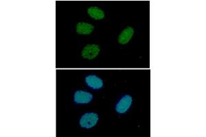 ICC/IF analysis of RuVBL in HeLa cells line, stained with DAPI (Blue) for nucleus staining and monoclonal anti-human RuVBL antibody (1:100) with goat anti-mouse IgG-Alexa fluor 488 conjugate (Green). (RUVBL1 Antikörper  (AA 1-456))