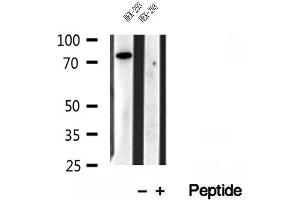 Western blot analysis of extracts of HEK-293 cells, using IFT81 antibody.