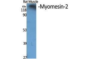 Western Blot (WB) analysis of specific cells using Myomesin-2 Polyclonal Antibody. (MYOM2 Antikörper  (Internal Region))
