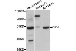 Western blot analysis of extracts of various cell lines, using CPVL antibody (ABIN6292365) at 1:3000 dilution.