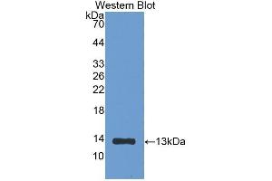 Western Blotting (WB) image for anti-beta-2-Microglobulin (B2M) (AA 21-119) antibody (ABIN1077856) (beta-2 Microglobulin Antikörper  (AA 21-119))