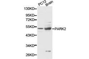 Western Blotting (WB) image for anti-Parkinson Protein 2, E3 Ubiquitin Protein Ligase (Parkin) (PARK2) antibody (ABIN1874032) (Parkin Antikörper)
