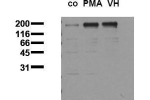Western Blotting (WB) image for anti-Epidermal Growth Factor Receptor (EGFR) (pThr678) antibody (ABIN126757) (EGFR Antikörper  (pThr678))