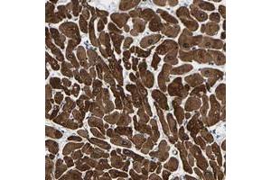 Immunohistochemical staining of human heart muscle with METTL16 polyclonal antibody  shows strong cytoplasmic positivity in myocytes at 1:200-1:500 dilution. (METTL16 Antikörper)