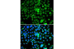 Immunofluorescence analysis of A549 cell using NAP1L3 antibody. (NAP1L3 Antikörper)