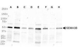 Western Blotting (WB) image for anti-Sema Domain, Immunoglobulin Domain (Ig), Short Basic Domain, Secreted, (Semaphorin) 3B (SEMA3B) (AA 100-200) antibody (ABIN1951824) (SEMA3B Antikörper  (AA 100-200))
