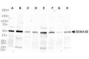Western Blotting (WB) image for anti-Sema Domain, Immunoglobulin Domain (Ig), Short Basic Domain, Secreted, (Semaphorin) 3B (SEMA3B) (AA 100-200) antibody (ABIN1951824) (SEMA3B Antikörper  (AA 100-200))