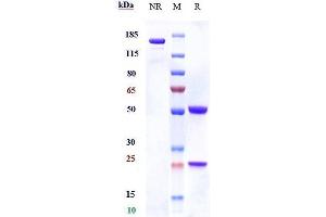 Anti-CSF2Rb / CD131 Reference Antibody (CSL311) on SDS-PAGE under reducing (R) condition.