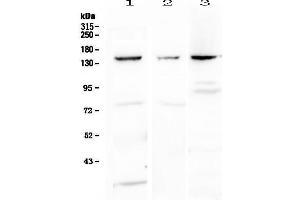 Western blot analysis of VEGF Receptor 1  using anti-VEGF Receptor 1  antibody . (FLT1 Antikörper)