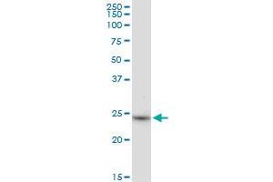 Western Blotting (WB) image for anti-3-hydroxybutyrate Dehydrogenase, Type 2 (BDH2) (AA 1-245) antibody (ABIN527994)