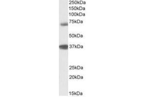 Antibody (1µg/ml) staining of Peripheral Blood Lymphocytes lysate (35µg protein in RIPA buffer). (TRIM29 Antikörper  (Internal Region))