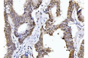 IHC analysis of Cyclophilin E/PPIE using anti-Cyclophilin E/PPIE antibody (ABIN7599242). (PPIE Antikörper  (AA 1-301))