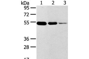 Western Blot analysis of Human thyroid and esophagus cancer, Human normal rectum tissue using TMPRSS11F Polyclonal Antibody at dilution of 1:500 (TMPRSS11F Antikörper)