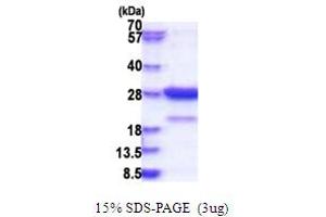 SDS-PAGE (SDS) image for Syntaxin Binding Protein 6 (Amisyn) (STXBP6) (AA 1-210) protein (His tag) (ABIN5853834)
