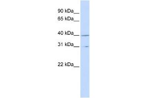 WB Suggested Anti-CCNH Antibody Titration:  0. (Cyclin H Antikörper  (Middle Region))