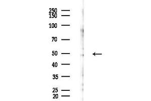 anti-1-Acylglycerol-3-Phosphate O-Acyltransferase 9 (AGPAT9) (Internal Region) antibody