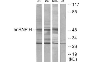 Western blot analysis of extracts from Jurkat cells, 293 cells and K562 cells, using hnRNP H antibody. (HNRNPH1 Antikörper  (Internal Region))