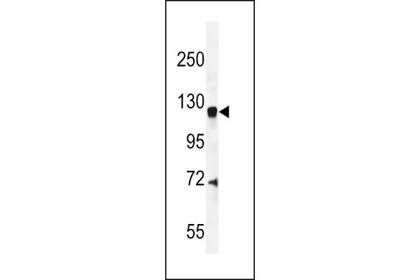 AGAP2 Antikörper  (C-Term)