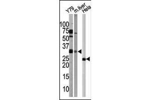 Western blot analysis of G5L Pab in Y79 cell line, mouse liver tissue, and Hela cell line lysates 1812b. (ATG5 Antikörper  (C-Term))